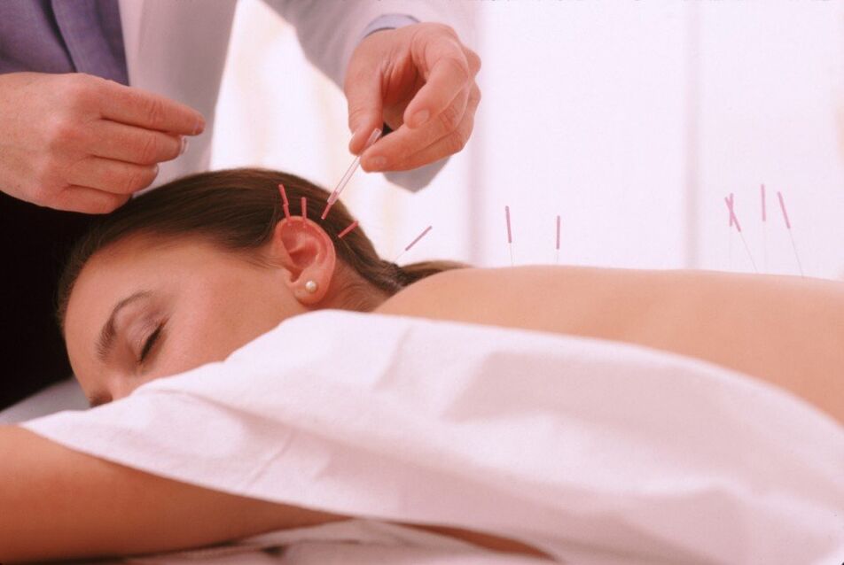 Acupuncture and acupunctures Cervical osteocondrosis