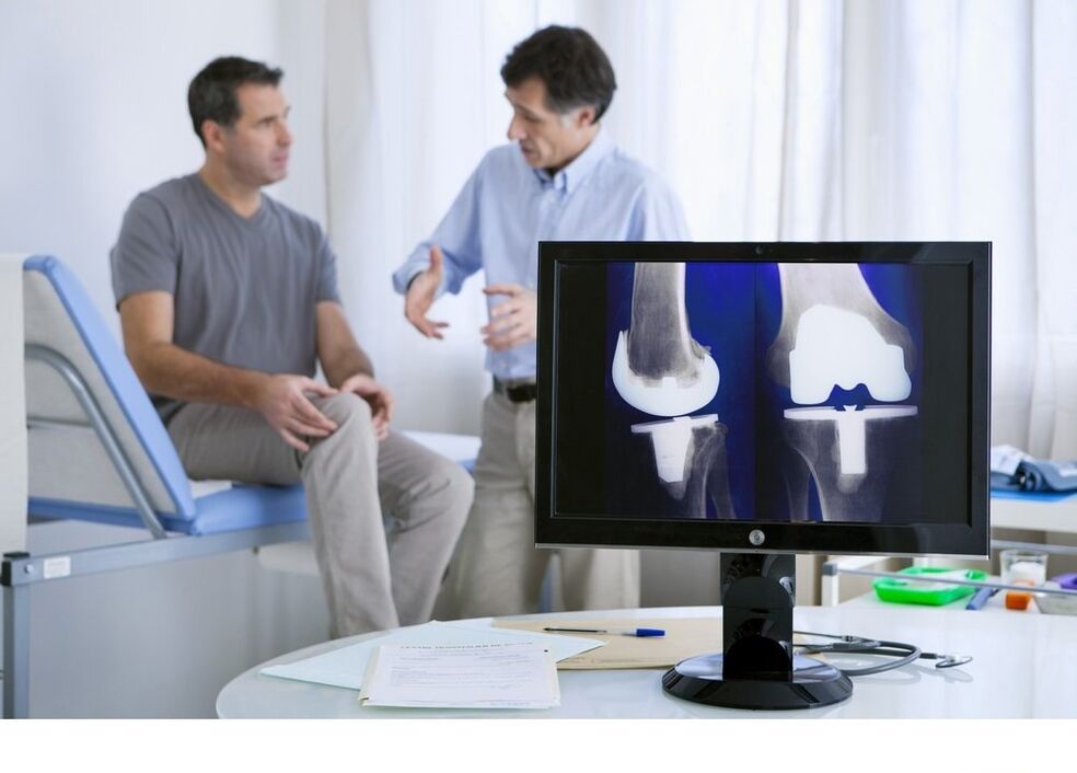 X -Ray's knee joint artrosis